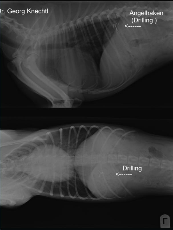 Entfernung Angelhaken mittels Endoskopie / Gastroskopie / Röntgenbild